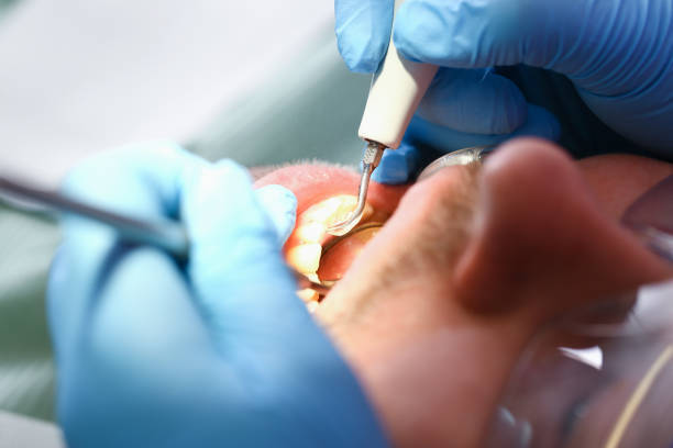Best Pediatric Emergency Dentist in Anson, TX