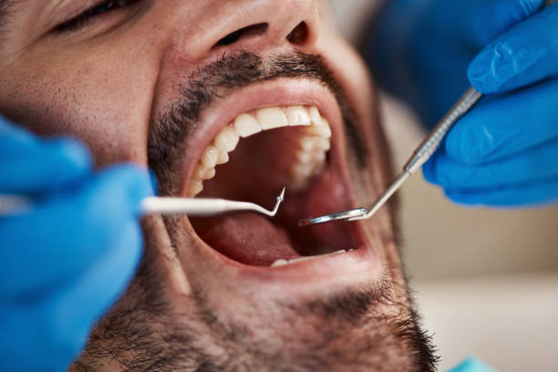 Best Emergency Dental Care for Abscessed Tooth in Anson, TX